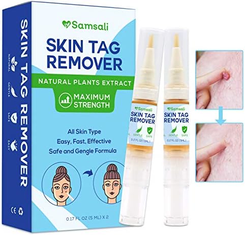 Samsali Skin Tag Remover, Best Skin Tag Remover For Removing Skin Tag