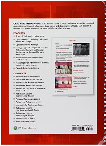Oral Hard Tissue Diseases: A Reference Manual for Radiographic Diagnosis - //medicalbooks.filipinodoctors.org
