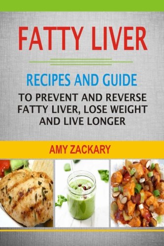 Fatty Liver: Recipes And Guide To Prevent And Reverse Fatty Liver, Lose Weight And Live Longer (Best Diet For Liver Disease)