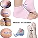 Codream Moisturizing Gel Heel Sleeves and Gloves, Gel SPA Gloves Socks Repair Cracked Skin and Exfoliate Skin,Soften Beauty Hands and Feet for Women