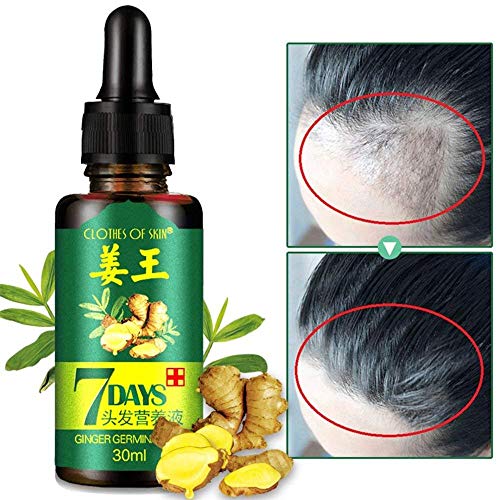 2PCS Ginger Germinal Oil Hair Growth Serum + Bonus Hair Comb | Ginger Hair Growth Serum | Ginger Essential Oil Hair Loss Treatment | Hair Regrowth Serum For Women & Men 30ML
