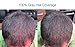 Thicken It 100% Scalp Coverage Hair Powders Talc-Free .32 oz. Water Resitant Hair Loss Concealer. Naturally Thicker Than Hair Fibers & Spray Concealers.