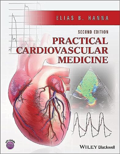 Nuclear Cardiology Review: Print + eBook with Multimedia: A Self
