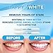 (3-Pack) Teeth Whitening Pen - Safe 35% Carbamide Peroxide Gel - No Sensitivity - Effective - Painless - Travel-Friendly - Easy to Use - Smart Tooth Whitener Pens - Natural Power Swabs by HAPPY WHITE