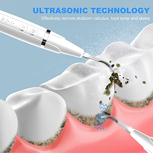 Plaque Remover for Teeth, Ultrasonic Tooth Cleaner Tartar Calculus Remover Tooth Stains Remover