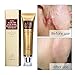Acne Scar Removal Cream,INST Skin Repair Face Cream Treatment,For Burns Cuts Operation Stretch Mark Remover ，Scar Hiding Acne Treatment Blackhead Whitening Cream (1PCS)