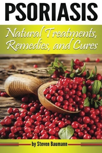 Psoriasis Natural Treatments, Remedies, and Cures: Your Guide to Psoriasis Home Treatment Options ( How to Cure Psoriasis Naturally At Home )