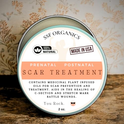 SSF Organics Scar Treatment for Stretch Marks, C-Section Recovery Must Have- Deeply Moisturize with Calendula, Castor, Shea - Advanced Scar Treatment for Mama Related Wounds