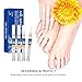 Votala Nail Fungus Treatment Pen, Biological Repair Pencil, Toenail Anti-Fungal Care, Fungal Nail Renewal Treatment and Cure, Highly Effective Revive Nails