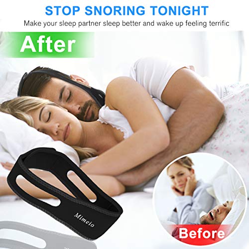[2019 Newest] Anti Snoring Chin Straps, Stop Snoring Solution Snore Reduction Sleep Aids,Anti Snoring Devices Snore Stopper Chin Straps for Men Women Snoring Sleeping Mouth Breathers - Thumbnail 2