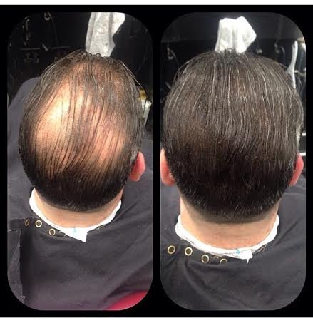 HAIR ILLUSION - 100% Natural Real Human Hair FibersNot Synthetic For Men & Women,Premium Hair Building Formulation, ~ LARGE 38g Bottle (dark brown)