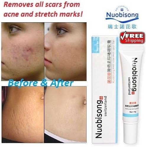 Nuobisong Face Care Acne Treatment Scar Stretch Marks Removal Whitening Cream by Nuobisong