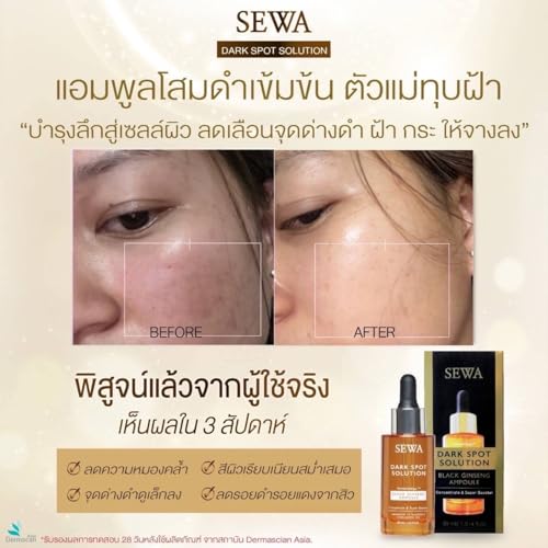 Sewa Dark Spot Solution Black Ginseng Ampoule Concentrate & Super Booster 30ml. Malasma Treatment, 1.01 Fl Oz (Pack of 1), Pack of 1