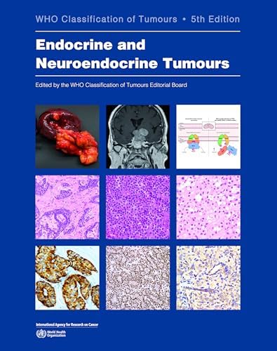 Breast Tumours: WHO Classification of Tumours (Medicine