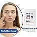 Acne Patches for Face - Hydrocolloid Bandages (24 Count) Pimple Patches for Face in 3 Universal Sizes, Acne Spot Treatment Care for Face & Skin Spot Patch Conceals Zits, Acne and Blackheads