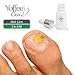 Yoffee Clear Advanced Nail Fungus Solution with Antibacterial Tea Tree and Moisturizing Argan Oil for Finger and Toe Nails, 10ml / 0.34 oz.