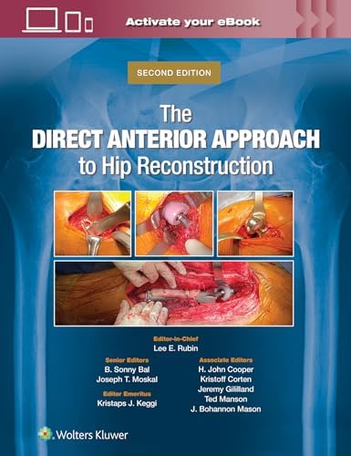The Adult Hip: Hip Arthroplasty Surgery Print + eBook with