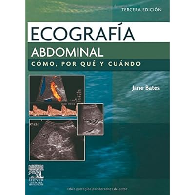 Ecografía abdominal. Cómo, por qué y cuándo Ecografía abdominal. Cómo, por qué y cuándo