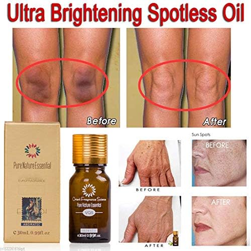 Dark Spot Remover Ultra Brightening Spotless Skin Care Pure Remover Ance, Age Spots Pigmentation Freckle Essential Oil (2 pcs)