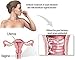 Yeast Infection Treatment Pill | #1 Gynecologist Recommended - Two Ingredients Needed for a Woman's Body - Get to The Core of Infections - Natural Health Bonus Ebook