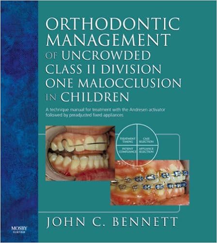 Orthodontic Management Of Uncrowded Class Ii Division One - 
