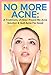Acne: No More Acne: A Testimony of How I Found My Acne Solution & Quit Acne For Good