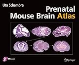 Prenatal Mouse Brain Atlas: Color images and annotated diagrams of: Gestational Days 12, 14, 16 and 18 Sagittal, coronal and horizontal section