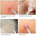 Whitehead Extractor Acne Comedone Pimple Milia Pus Zit Blackhead Remover Blemish Treatment Pore Cleaner Precision Needle, Made with Surgical Steel, opove EX1