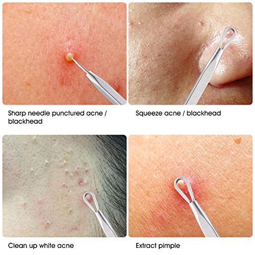 Whitehead Extractor Acne Comedone Pimple Milia Pus Zit Blackhead