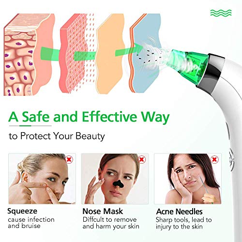 Blackhead Remover Pore Vacuum Cleaner LONOVE Upgraded Blackhead