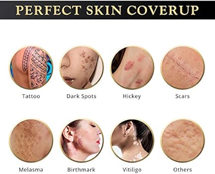 vitiligo concealer