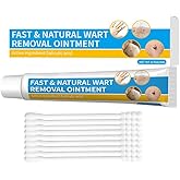 Wart Remover 20g, Genital Wart Removal Cream, Wart Remover, Suitable for Men and Women, Gentle and Non-irritating, No Scarring