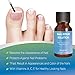 Evagloss Natural Nail Repair Solution - for Toenail and Fingernail Fungus, Restores Discolored and Damaged Nails