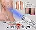 Eurobuy Powerful Anti-varicose Veins Face Acne Removal Pen (Battery not included)(Style A)