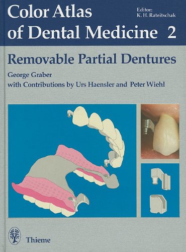 Buy Removable Partial Dentures Vol 2 Color Atlas Of Dental Medicine Vol 2 Book Online At Low Prices In India Removable Partial Dentures Vol 2 Color Atlas Of Dental Medicine Vol Buy Removable Partial Dentures Vol 2 Color Atlas Of Dental Medicine Vol 2 Book Online At Low Prices In India Removable Partial Dentures Vol 2 Color Atlas Of Dental Medicine Vol