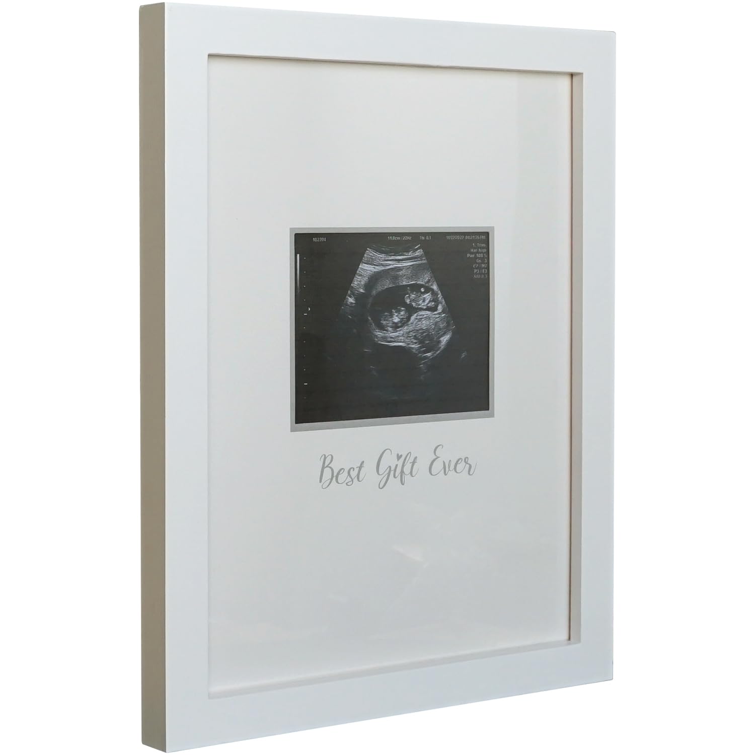 HAMUIERS Sonogram Signature Frame Guest Book, Ultrasound Picture Keepsake Frame, Baby Shower Guest Book Alternatives, Gift for Expecting Moms, White