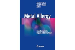 Metal Allergy: From Dermatitis to Implant and Device Failure