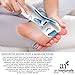 ArtNaturals Rechargeable Electric Callus Remover - Most Effective Electronic Pedicure Foot File Callus Remover, Removes The Coarse, Tough Skin On Your Feet, Spa like Treatment With Guaranteed Results!