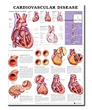 Cardiovascular Disease Anatomical Chart, Anatomical Chart Company Staff, 1587798417
