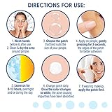 Clear24 Acne Patch, 144 Count