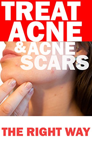 Treat Acne & Acne Scars Ebook