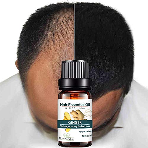 Kasien Hair Growth Liquid, Natural Ginger Hair Growth Essence liquid Fast Hair Growth Natural Hair Loss Treatment (2 Pcs)