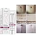 Enjoyment Scars Removal Cream Stretch Marks Cream Pregnancy Skin Care Belly Butter - Plant Nutrition Repair Ingredients to Help Prevent & Reduce Stretch Marks, 40G/1.4oz
