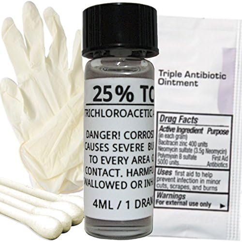 TCA Skin Peel Kits - Professional Strength - Remove Tattoos, Age Spots, Stretch Marks, Acne Scars, Moles, Scars, Skin Tags, Hyperpigmentation, Wrinkles & Freckles! (25)