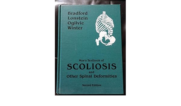 Scoliosis and other spinal deformities