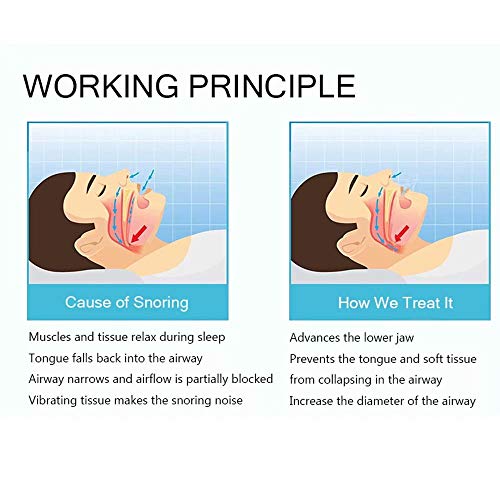WesGen 2 Pack Mouth Guards for Teeth Grinding, 2019 Upgraded Aid Snore Reducing for Natural and Comfortable Sleep - Thumbnail 4