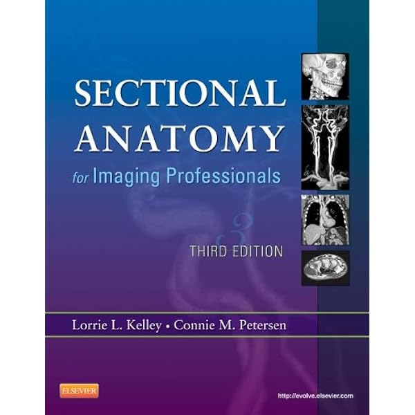 Amazon.com: Workbook for Sectional Anatomy for Imaging