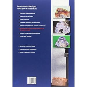 PROTESIS PARCIALES Y REMOVIBLES METALICAS, DE RESINA Y MIXTA (TECNICO SUPERIOR EN PROTESIS DENTALES)