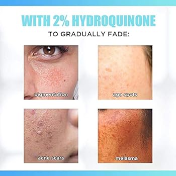 skin bleach for hyperpigmentation