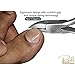 Ingrown Toenail Tool - Stainless Steel Surgical Grade Toe Nail Clippers Tools, Travel Kit for Personal Care Treatment | Thick Toenails, Manicure, Pedicure Set | 4 Pieces Cutter Lifter Filer Corrector